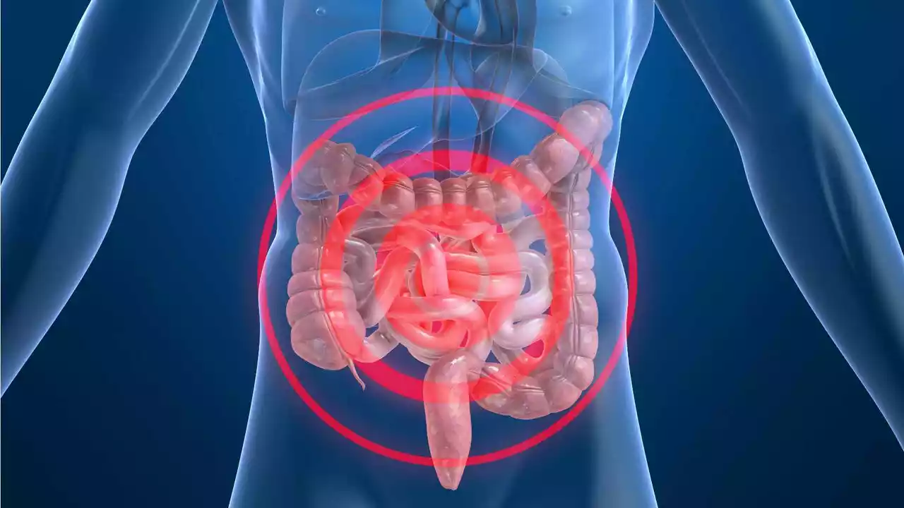 Cefadroxilo para Infecciones Gastrointestinales: Una Guía